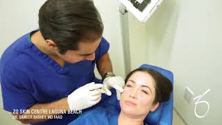 BELOTERO BALANCE® Dermal Filler for Under Eye at ZO Skin Centre [upl. by Eliason]