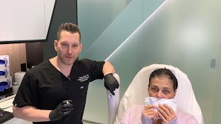 Female Facial Sculpting with Belotero  Smokers Lines and Lip Rejuvenation  West Hollywood CA [upl. by Eidnam]