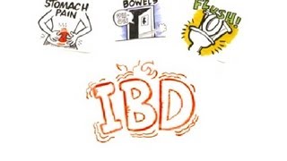 Inflammatory Bowel Disease IBD [upl. by Serles]