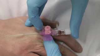 Cannulation How to gain IV access [upl. by Desai]