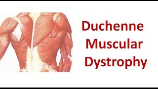 Duchenne Muscular Dystrophy [upl. by Madoc14]