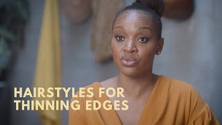 What Hairstyles to Wear if You Have Thinning Edges  Pretty Shouldnt Hurt [upl. by Alecia659]