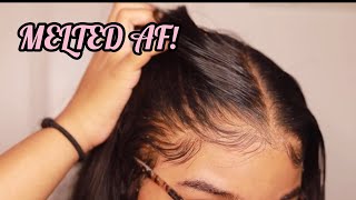 How to RE Install Frontal Wigs for Beginners  VERY DETAILED  Melt Transparent Lace [upl. by Brennen626]