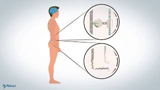 Douleurs neuropathiques et dysfonctionnelles explication [upl. by Service]