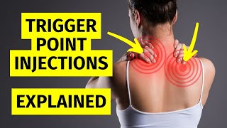 Myofascial Pain Trigger Point Injections Explained [upl. by Atekihs]